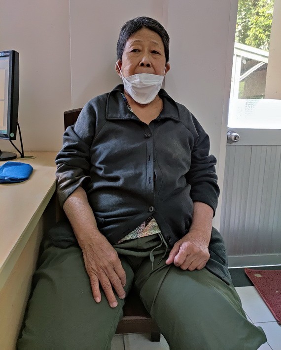 鍾鳳玲患上腎衰竭導致雙腳浮腫，行動不便。