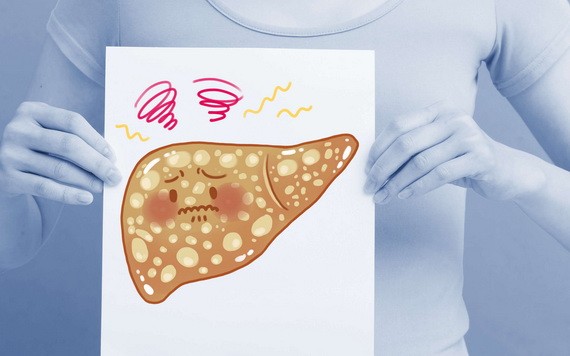 肝臟震波檢查及早揪出肝纖維化