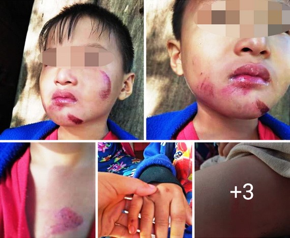 自2022年1月1日起，據《行政違規處理法》，對於有家庭暴力行為者（受害者是配偶、孩子、父母、兄弟姐妹、照顧者等），可以按行政手續暫扣。 