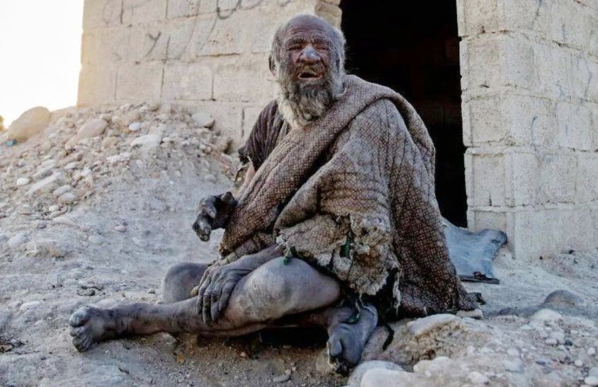 哈吉生前多年沒有洗澡。（圖：互聯網）