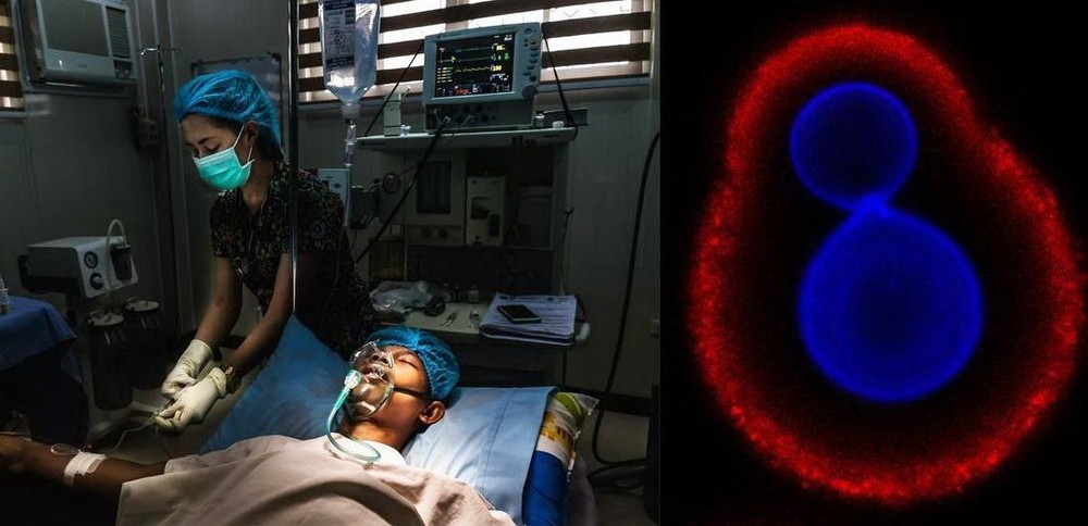 真菌病原體越來越常見，而且對治療藥物的耐藥性越來越強，對公共衛生構成了重大威脅。（示意圖：聯合國）