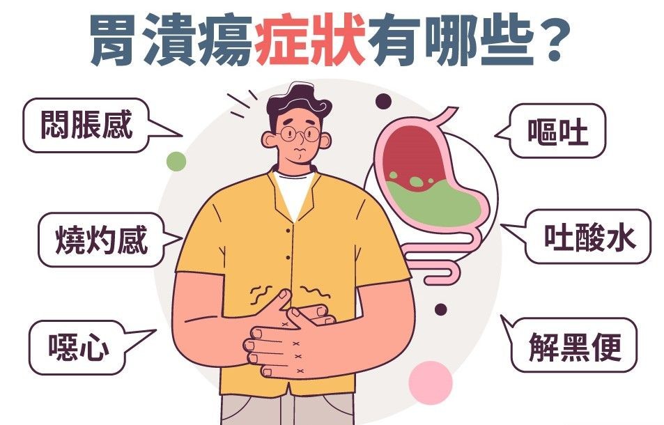 胃潰瘍常見症狀有悶脹感、燒灼感、噁心、嘔吐、吐酸水、解黑便等。