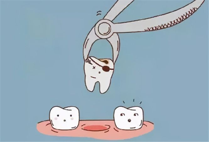 拔牙後３個時間點很關鍵！