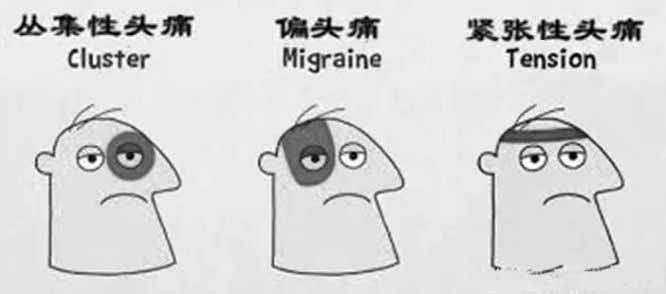 ５招應對叢集性頭痛