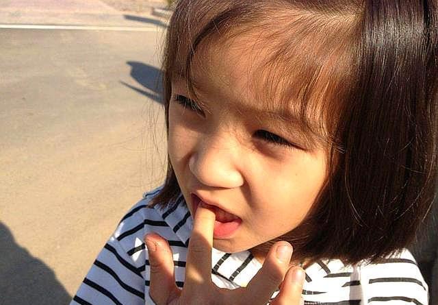 孩子啃指甲「成癮」是缺乏維生素？