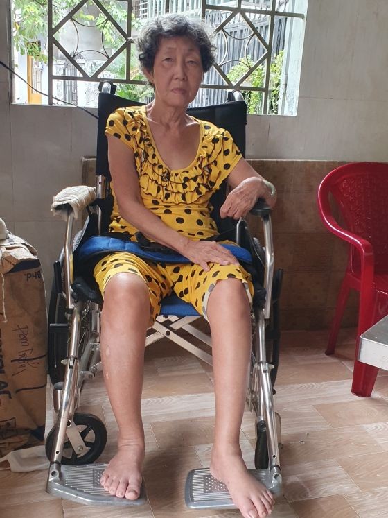 梁美珍的生活不能自理。