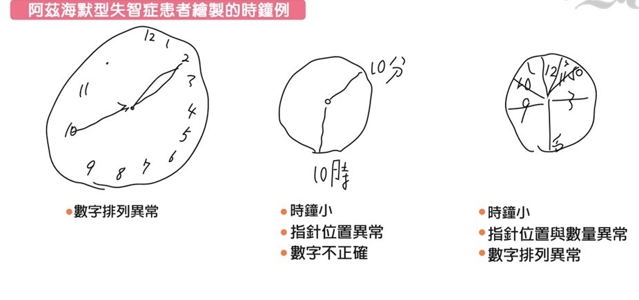 长辈有没有失智 画时钟就能知道