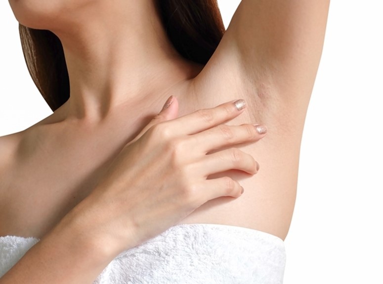 40岁女腋下长脂肪颗粒竟是高血脂找上门！