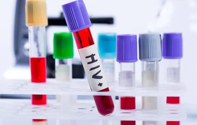 干细胞移植或可抑制爱滋病病毒