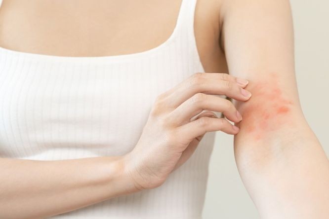 中医从３类型分析皮肤问题