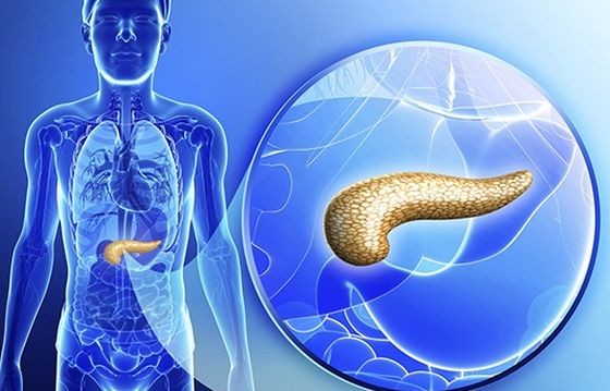 你真的了解胰腺癌吗？