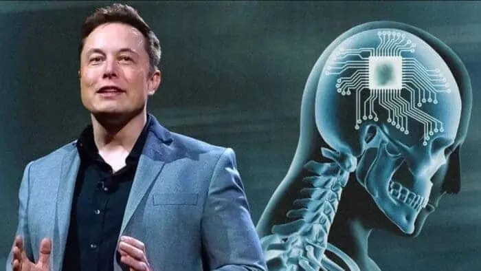马斯克企业获准开展脑机连接人体试验。（示意图：互联网）