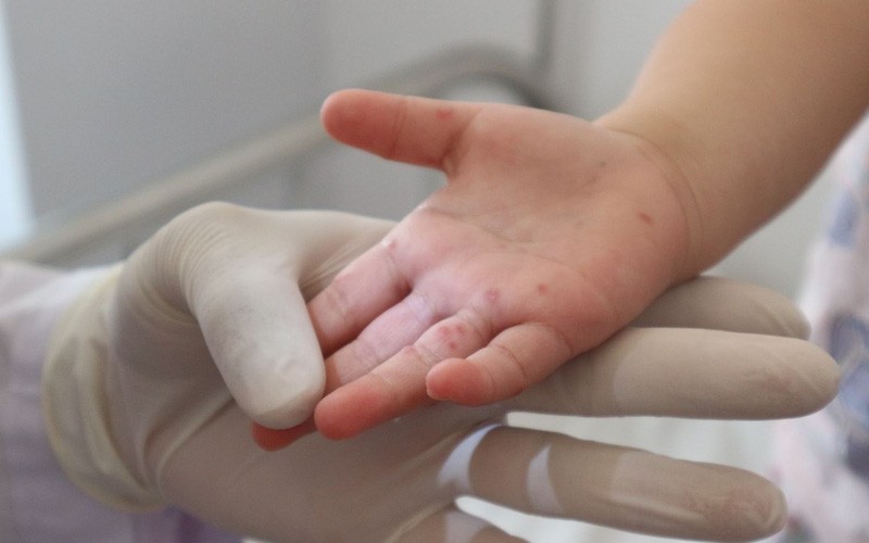 （示意图：互联网）