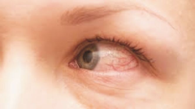 新冠为啥会连累眼睛？