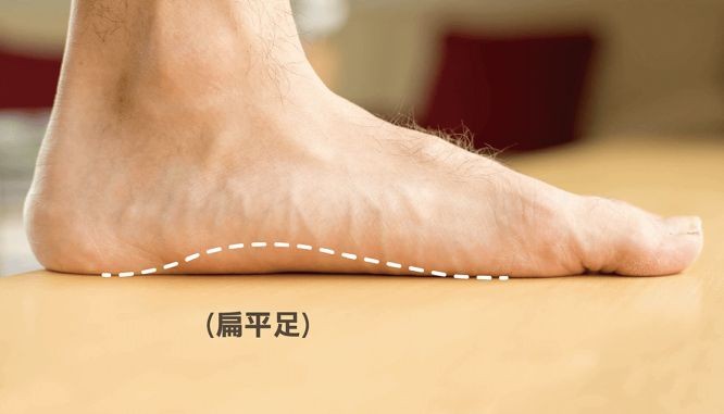 常腰酸背痛要小心