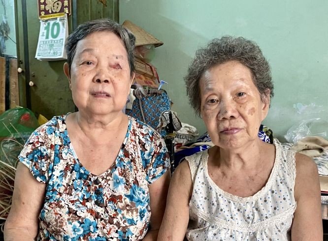 杜雪英两姐妹，左边是眼皮癌的姐姐。