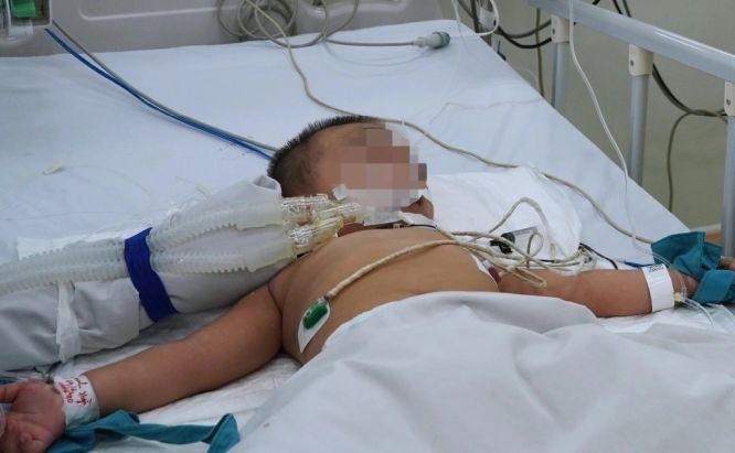 一名重症手足口病童住院接受治疗。（图：KD）