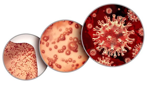 （示意图：互联网）