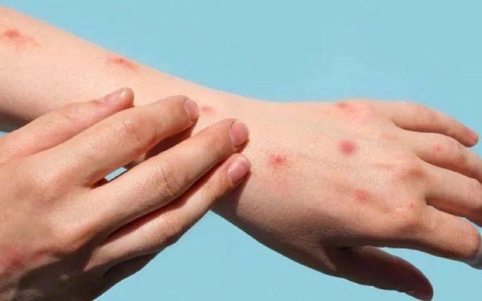 （示意图：互联网）