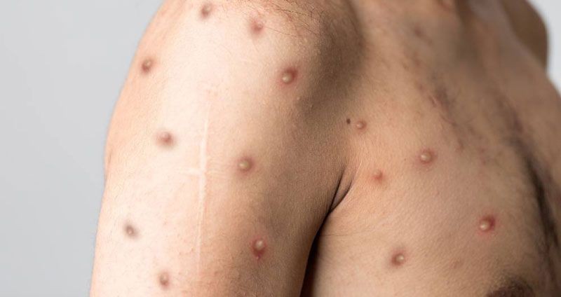 （示意图：互联网）