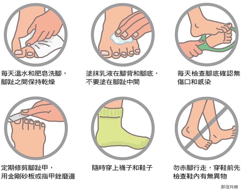 戒烟、控糖、护足 预防糖尿病足发生