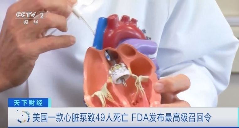 美 FDA 就一款心臟泵因安全风险发最高级召回令