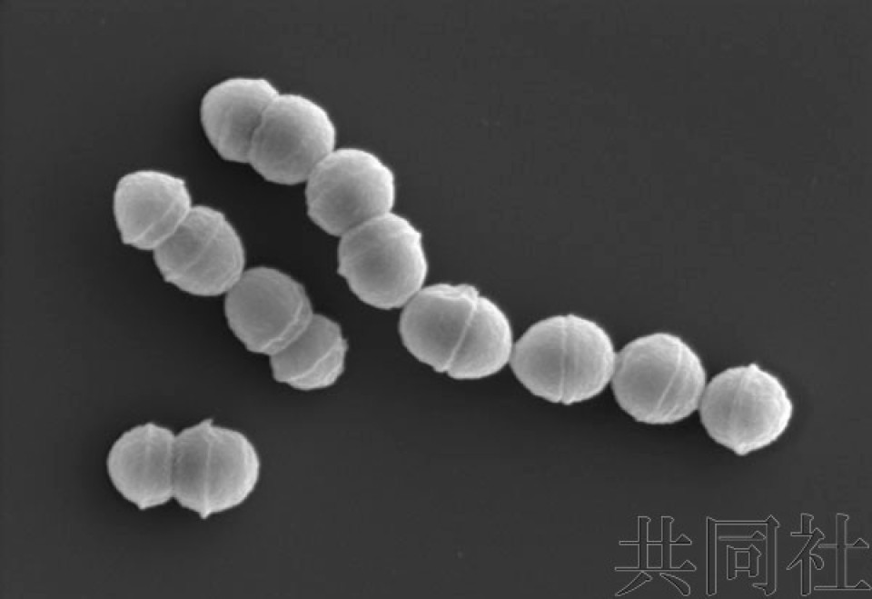 图为感染“链球菌中毒休克综合征”的主要原因物质“A组溶血性链球菌”。（图：共同社）