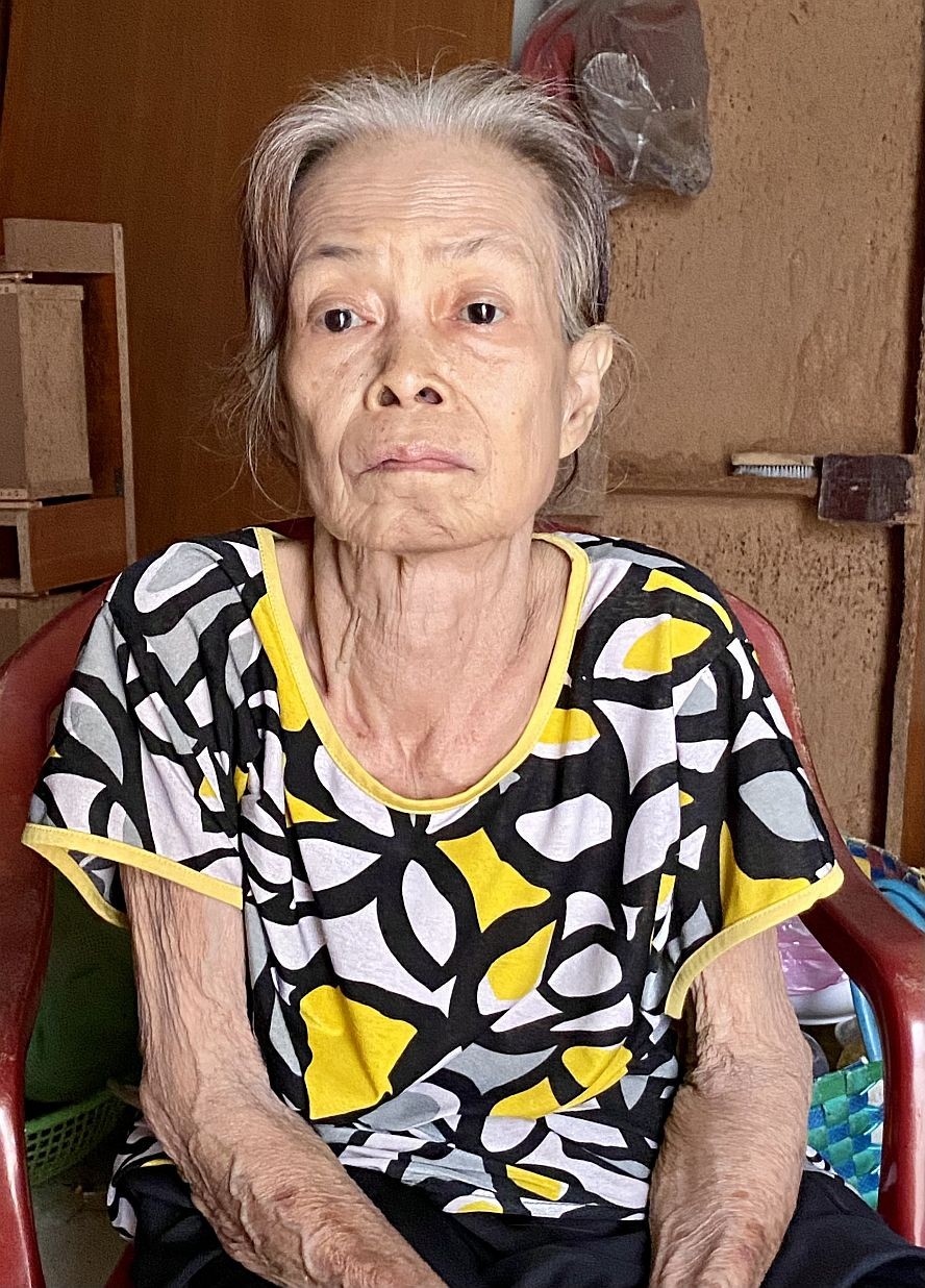 老妇膝痛不能谋生