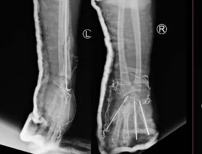 hinh 2 tai-nan-phao-no-2.jpg