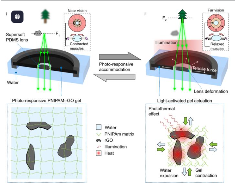 仿生软镜片可像人眼一样自动调焦