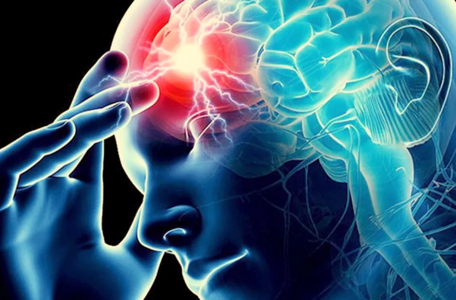 Ứng dụng trí tuệ nhân tạo trong chẩn đoán điều trị đột quỵ ảnh 1