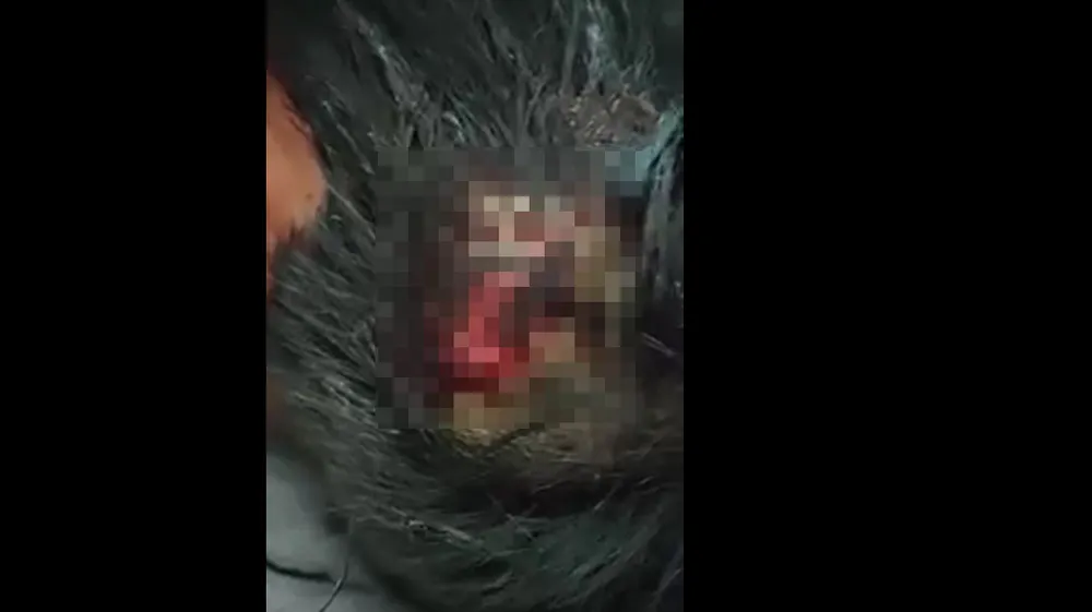 Xung đột đổ máu tại công trường điện gió Sóc Trăng ảnh 1