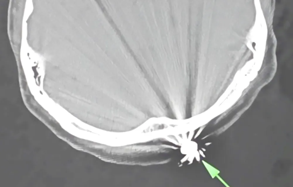 Vien dan sau dau.jpg