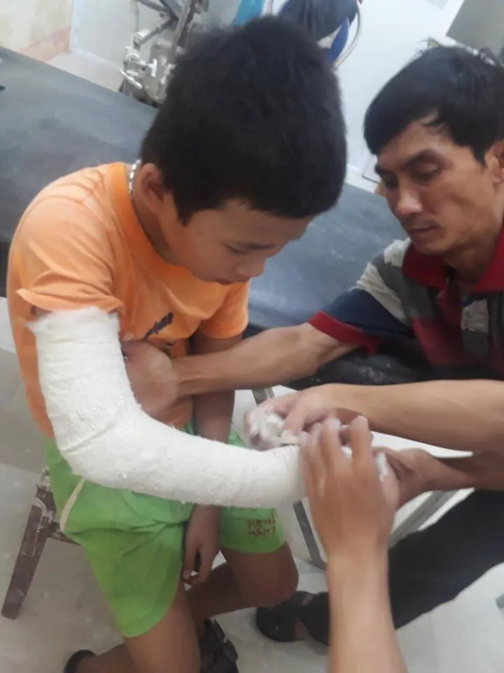 Bắt đối tượng cướp tiền, đánh gãy tay bé trai 13 tuổi bán vé số dạo ảnh 1