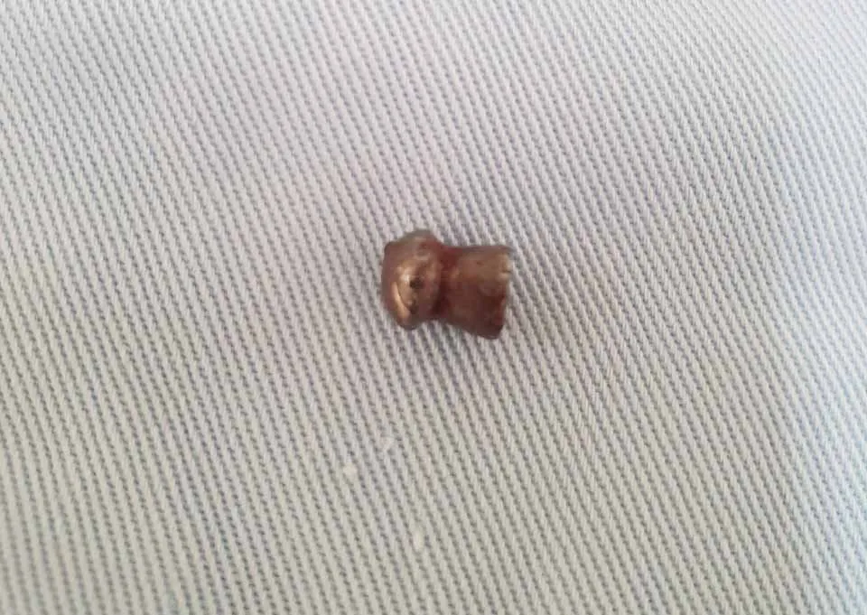 Anh rể “thử” súng bắn trúng em vợ ảnh 1