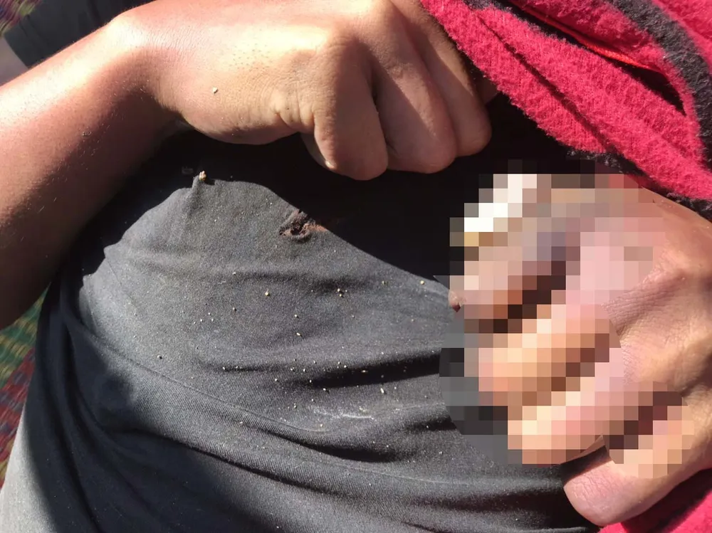 Điện thoại phát nổ khi đang sạc, nam thanh niên tử vong ảnh 1