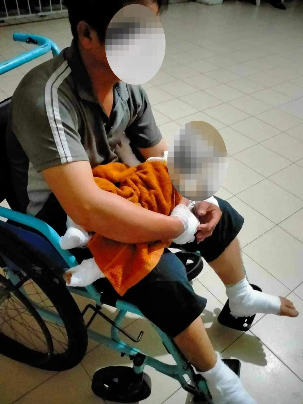 Anh L. và cháu A. bị bỏng sau vụ bị tấn công bằng bom xăng. Ảnh: NDCC