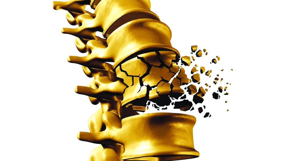 Ô nhiễm không khí làm tăng nguy cơ loãng xương 