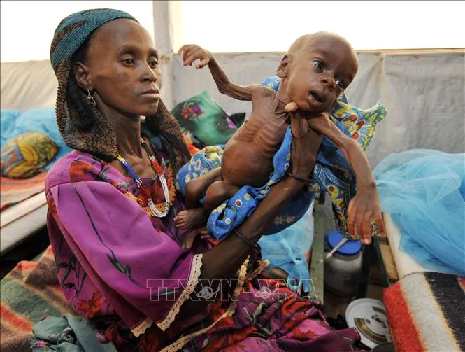 Trẻ em bị suy dinh dưỡng tại Tanout, nam Niger. Ảnh minh họa: AFP/TTXVN