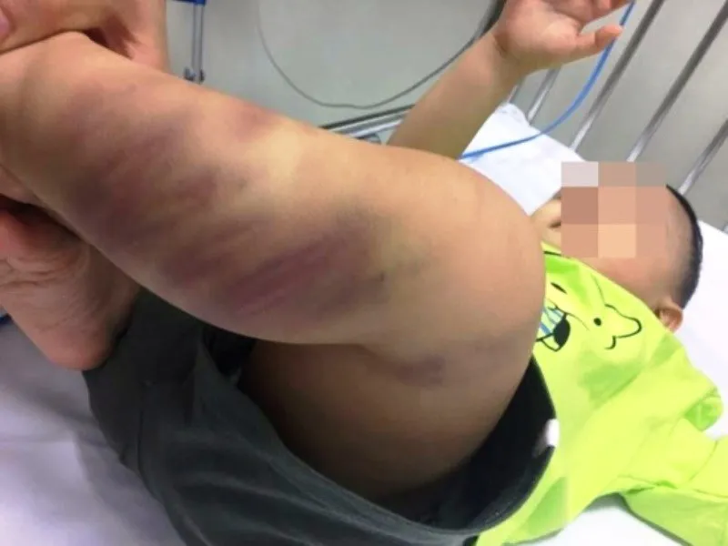 Khởi tố điều tra vụ bạo hành bé trai mới 1 tuổi  ảnh 2