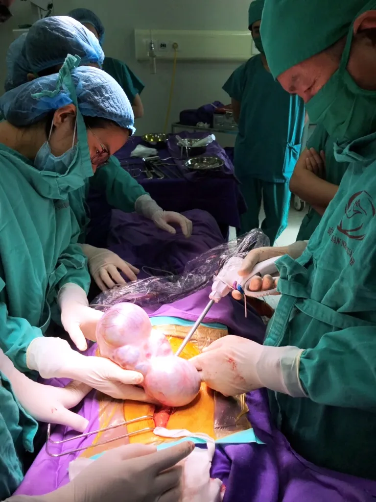 Khối u buồng trứng kỳ quái mang hình thù bào thai 2 đầu ảnh 1