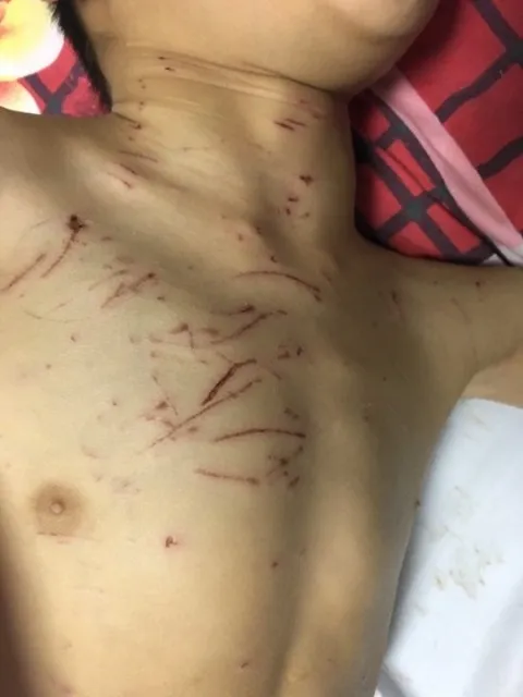 Xót xa bé trai bại não bị 4 con chó nhà cắn xé ảnh 2