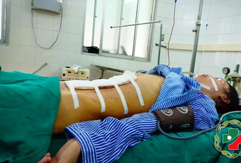 Thiếu nữ 22 tuổi “đốt ngải” để trị khối u buồng trứng gần 8 kg ảnh 3