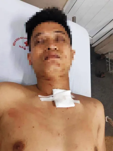 Vụ nam thanh niên dùng kéo đâm chết bạn gái: một CSGT bị đình chỉ ảnh 1