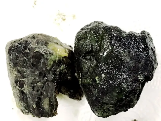 Ruột vón cục như nhựa đường vì thường xuyên uống trà sữa ảnh 2