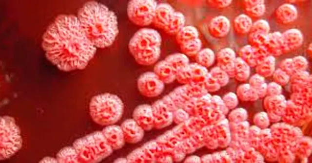 Một gia đình chỉ trong nửa tháng có 2 trẻ tử vong vì khuẩn Whitmore ảnh 1