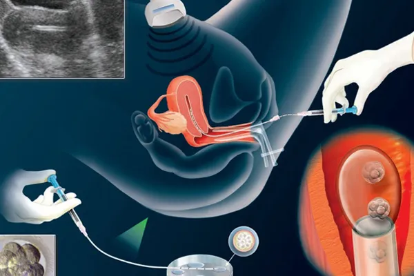 Đẻ thuê, mang thai hộ vì mục đích thương mại ngày càng phức tạp ảnh 2