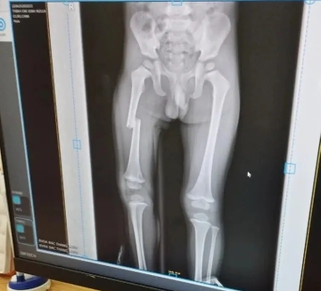 Lập hồ sơ xử lý người phụ nữ đạp gãy chân con trai ảnh 2