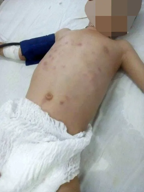 Bắt đối tượng đánh đập con riêng người tình đến vỡ ổ bụng ảnh 2