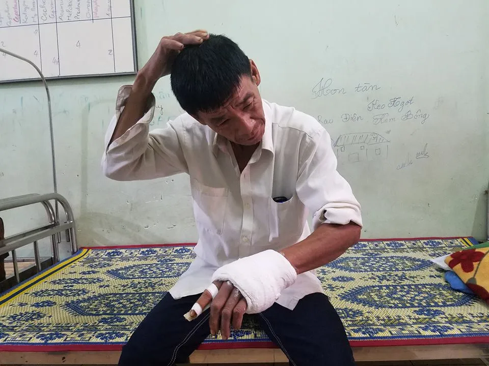 Điều tra vụ Phó Trưởng Công xã bị tố dùng dao đánh dân ngay tại trụ sở ảnh 1